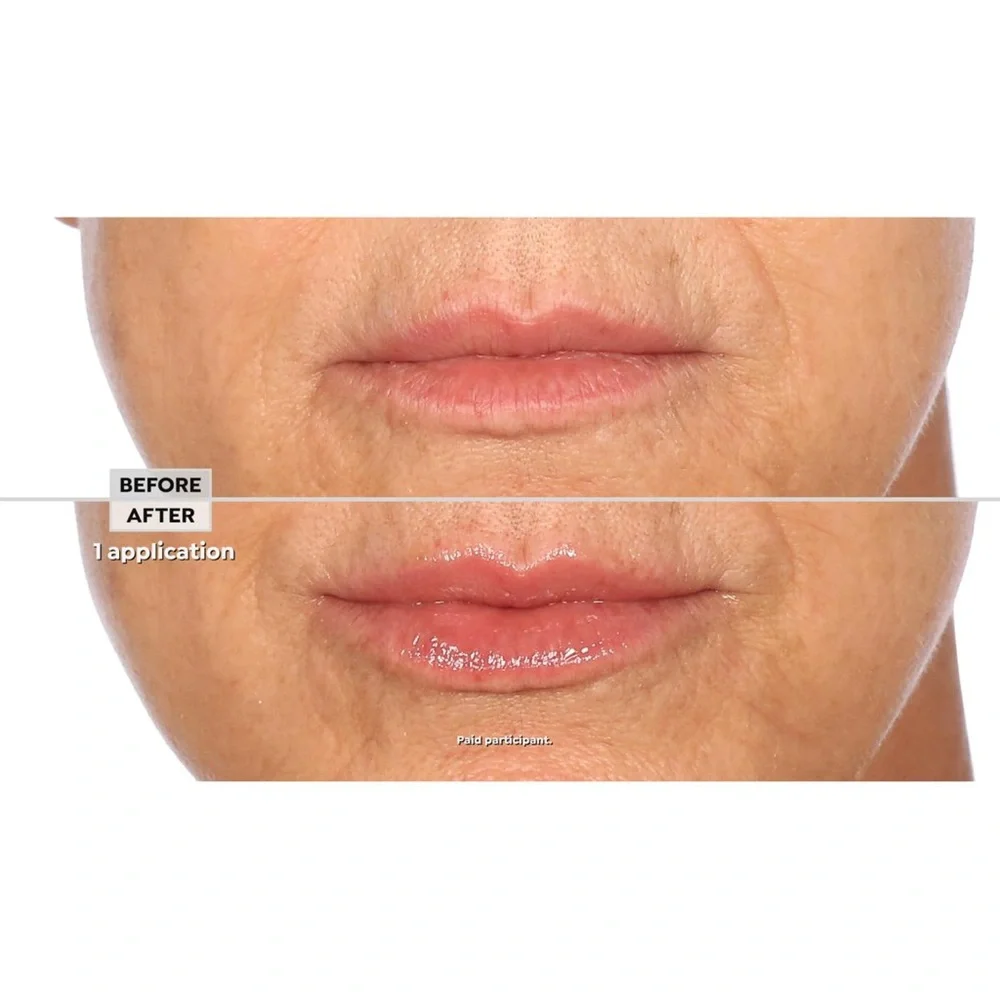 Nakery Beauty Lip Treatment - Cream